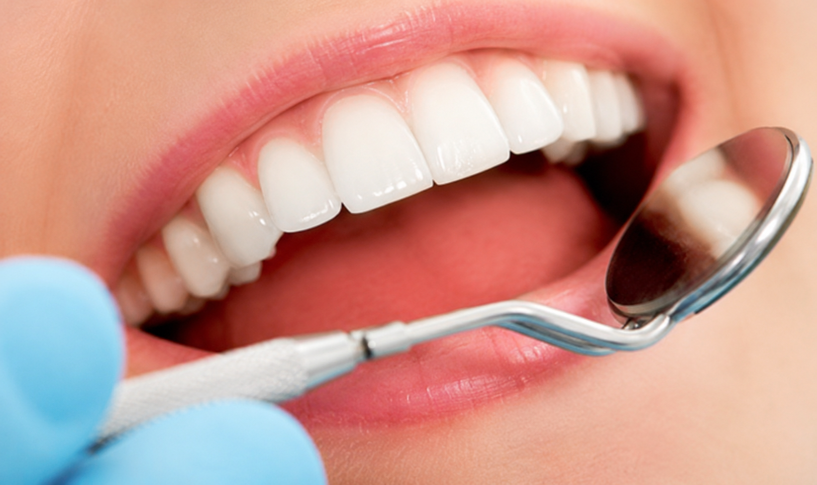 Dental Check-Ups & Cleaning
