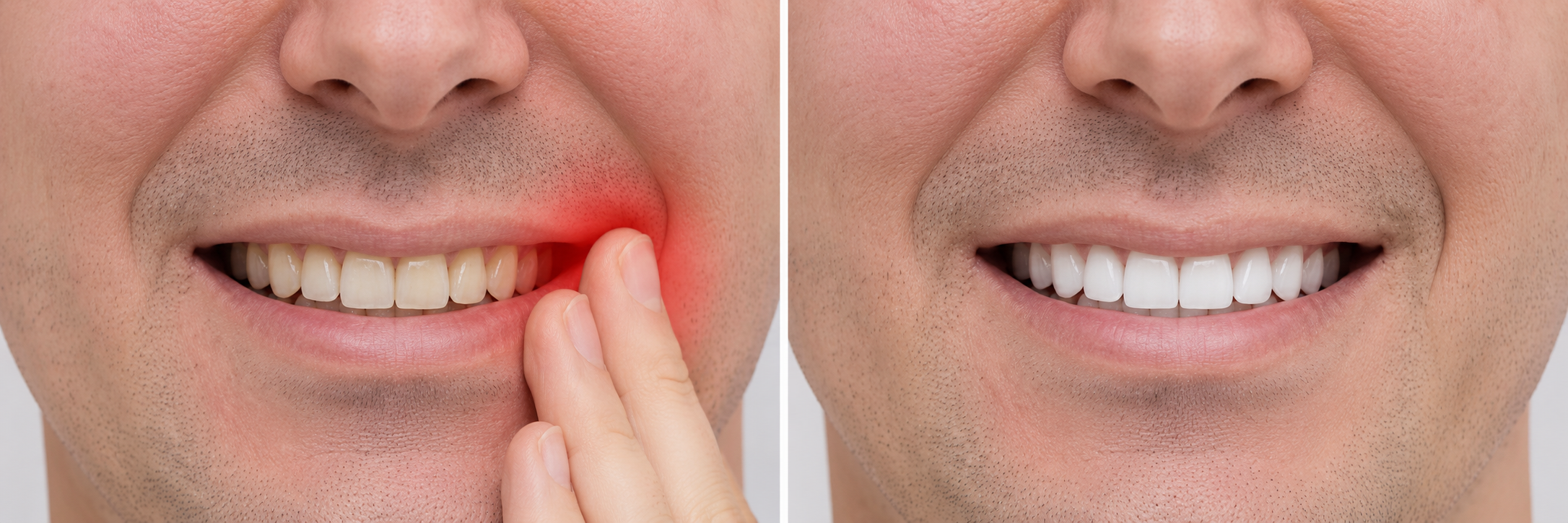 Toothache Pain Relief Treatment