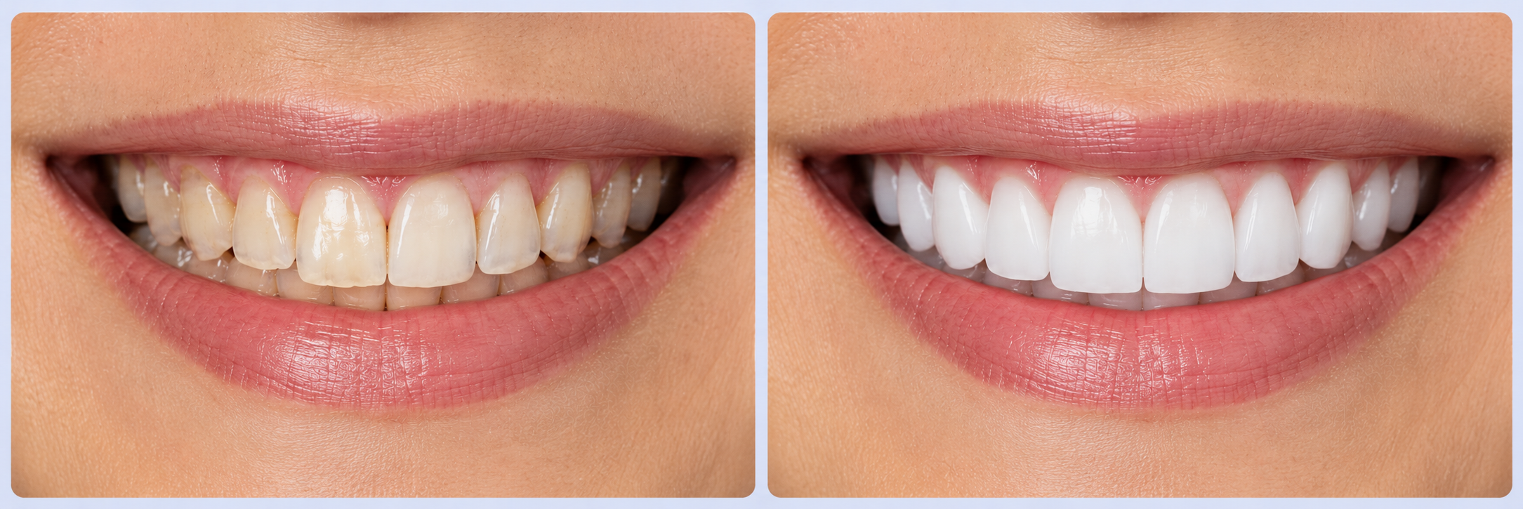 Before & After Smile Makeover Victoria Park
