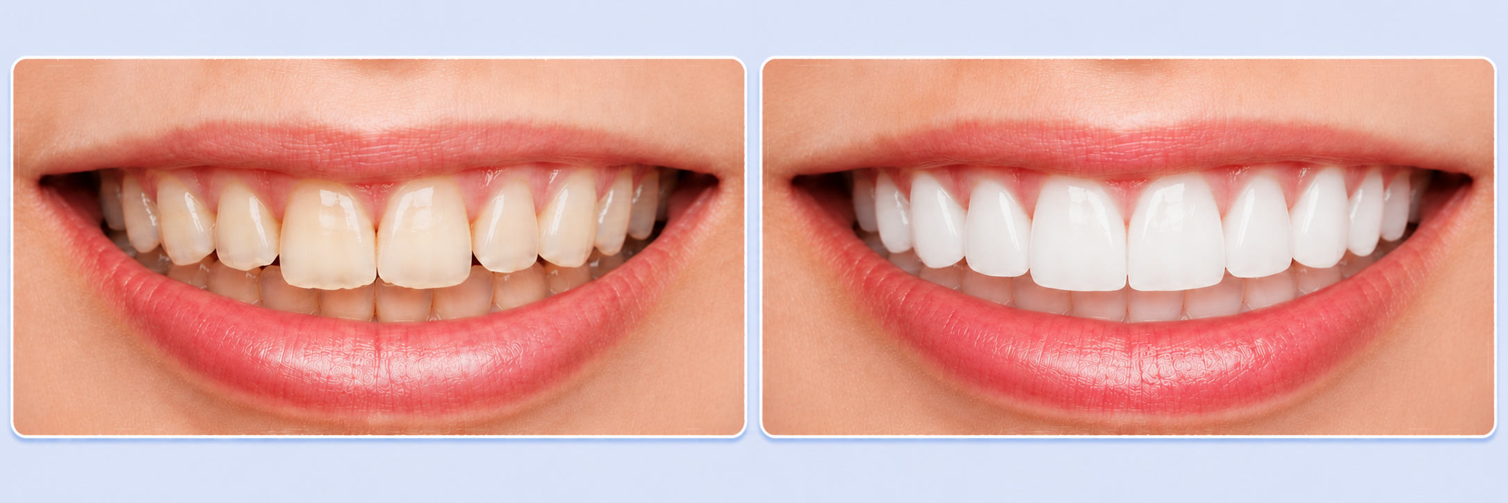 Cosmetic Dentistry Victoria Park After Before